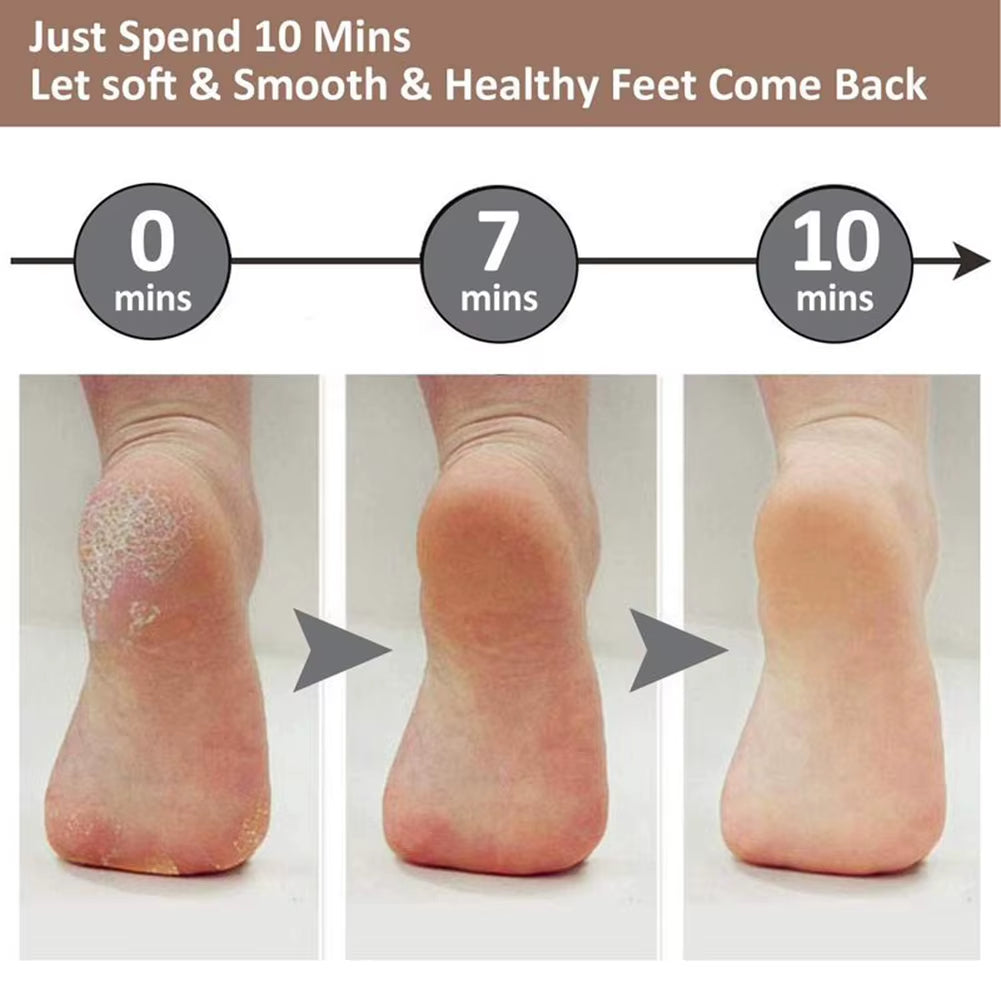 Electric Callus Remover for Feet,Rechargeable Foot Exfoliator Foot Scrubber Pedicure Tools,Removes Dry Skin for Smoother Feet
